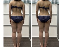 ソレイユ ベル(Soleil Belle)/☆施術例☆