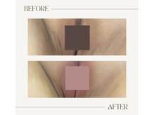 サロンウム(Salon umu)/粘膜ケアに