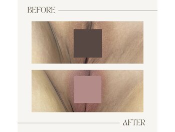 サロンウム(Salon umu)/粘膜ケアに