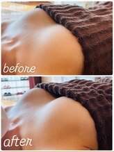 シズク ビューティーサロン(SHIZUKU beauty salon )/NBS Before After AWARD入賞