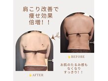 アミュレット(amulette)の雰囲気（しっかりと痩身効果プラス、凝り解消でリラクゼーション効果◎）