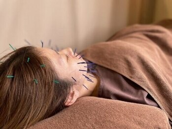 こじま 富雄団地接骨院の写真/【美容鍼でハリ・ツヤUP】むくみ・小顔・たるみ改善◎話題のヒト幹細胞と美容鍼でワンランク上の美肌へ！