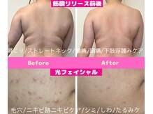 CBDサロン ローズ(ROSE)
