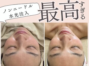 マヴィ 守口店(MavY.)/内側からの潤い感じます！