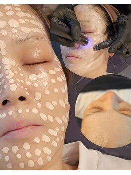 ファットママ(FAT MAMA)の写真/韓国・海外で大流行中の最新ケア！メソスキンカラーでくすみをケアし、透明感溢れるパッと明るいツヤ肌へ◎