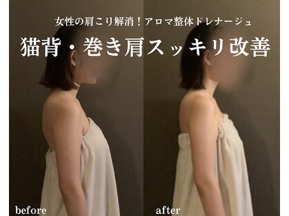 ミトラ(MITRA)の写真