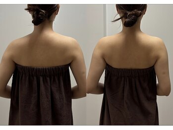 スキャプレーン 米子(SCAPLANE)/BEFORE AFTER事例