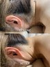 【1回で実感◎感動のボサボサうなじ改善】シェービング付うなじ脱毛