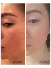 リッチサロン(Rich Salon)&nbsp;Hayakawa 