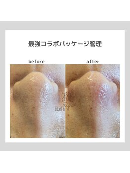 ポムハヌル(pom.haneul)/韓国肌管理室