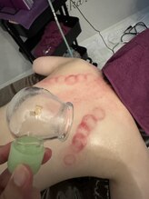 ミカ ネスト(Mika Nest)/ウェーブカッピング