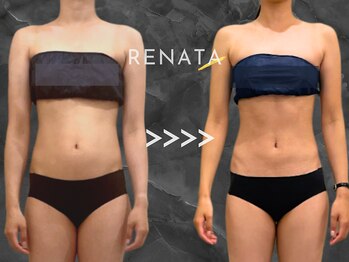 レナータ 新宿店(RENATA)/Before / After