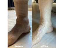 はりきゅう 藤田/足の痛みの改善は足から！