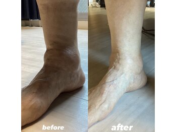 はりきゅう 藤田/足の痛みの改善は足から!