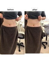 ジョワイユ(Joyeux)/腸の位置でお腹は変わる