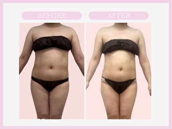 アコガレコガオ 八戸店/