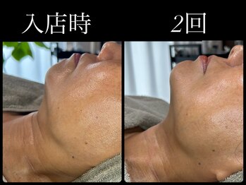 ビーエルティー(blt)/レモンボトル