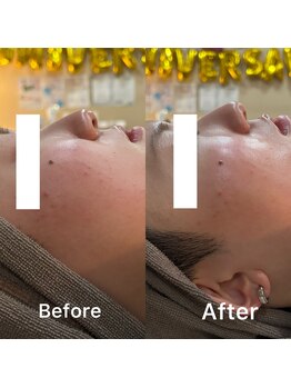 リラ 郡山店(Lilas)/浮腫みを撃退！