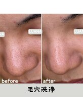 ルアナ 北谷店/毛穴洗浄毛穴ケア 《沖縄/北谷》