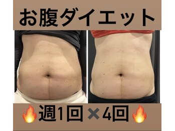 リセラージュ(Recellage)/