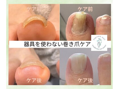リケアネイル(Re:care nail)の写真
