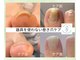 リケアネイル(Re:care nail)の写真