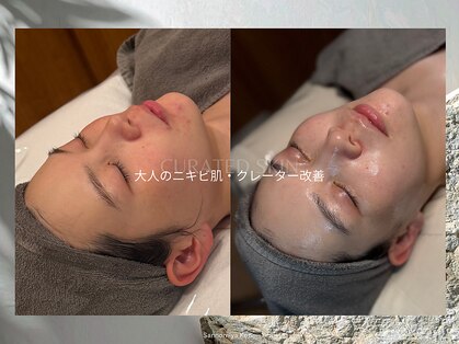 キュレイテッドスキン(CURATED SKIN)の写真