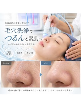 Total beauty salon SOIA【ソワエ】横浜天王町/毛穴・小顔・痩身・リンパマッサージの写真/【毛穴の黒ずみ・開きを徹底集中ケア】毛穴洗浄×ツヤ肌ケアでザラつきのない透明感あふれる美肌へ★