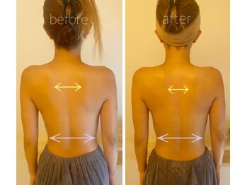 パル コルギサロン(Pal. Korugi salon)/コルギビフォーアフター