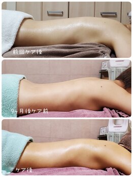 ソエルテ(Soelte)/サイズダウンへ導くリンパケア