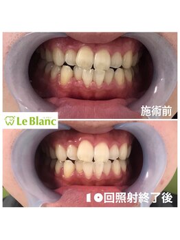 ルブラン 奈良店(Le Blanc)/いよいよ明日です！