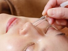 アカアカ(aka'aka)/毛穴改善フェイシャル