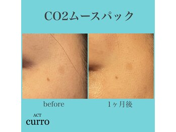 アクト クロ(ACT curro)/CO2ムースパック経過