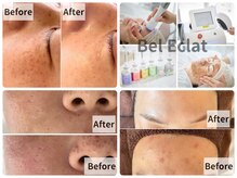 ベルエクラ(Bel Eclat)