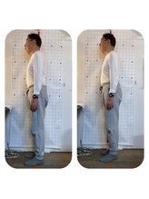 ハンズ治療院 東中野院/「姿勢矯正の症例」