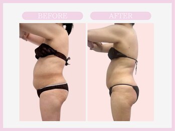 アコガレコガオ 八戸店/