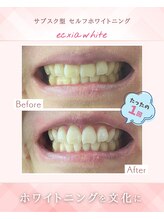 エクシアホワイトニング 江坂店/ビフォーアフター