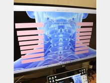 健志接骨院/神経の状態をチェック