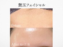 アンドミルル(and Milulu)/【韓国艶玉フェイシャル】