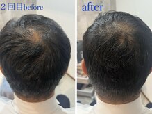 マイントゥー(mine too)の雰囲気（ハイパワーマシンと高濃度漢方でその場で効果を実感！育毛促進！）