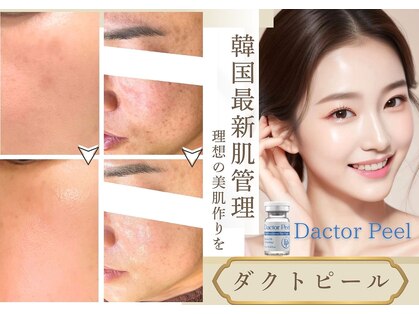 ルーセントの写真