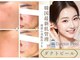 ルーセントの写真
