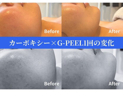 ステラ(STELLA)の写真