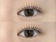 エルブリンク(elblink)の写真