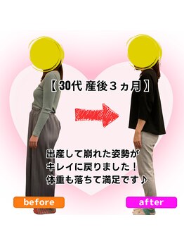 さらさ整骨院/産後骨盤矯正ビフォーアフター