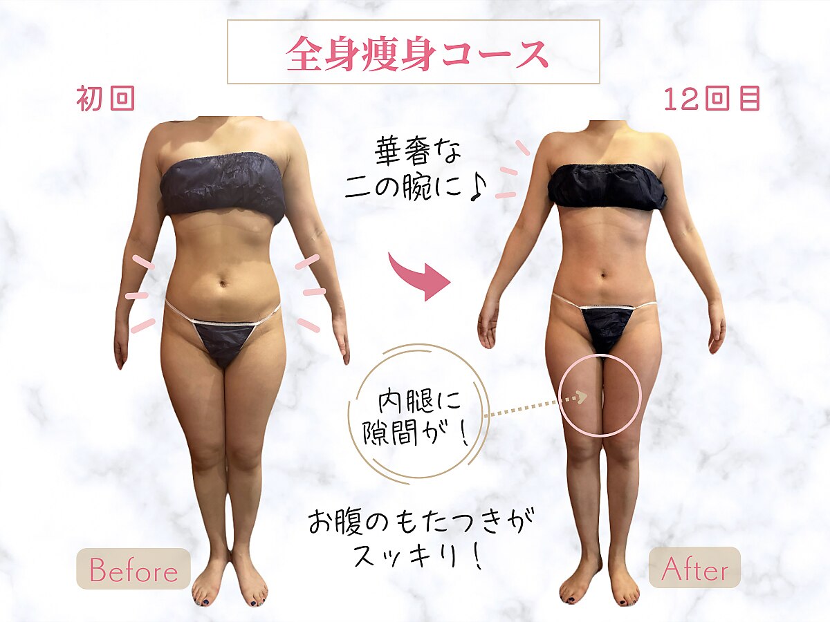 ビューティエン(beauty EN)｜ホットペッパービューティー