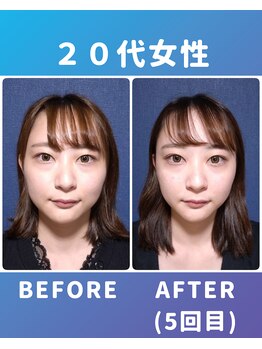 ぐっすりん/複数回継続のお客様の変化(2)