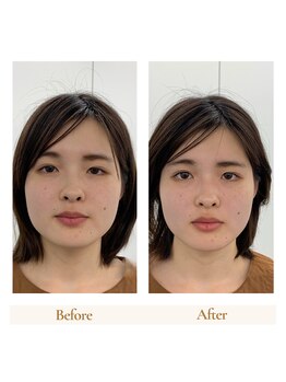 ストレッチヒーロー 倉敷中庄店/小顔矯正ストレッチでの変化