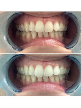 エスプライザ 鹿児島天文館店(ESPLIZA)/