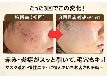 おうちサロン ミキの写真